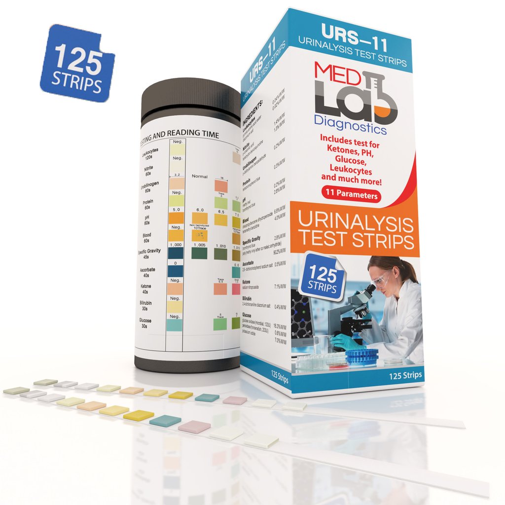 Urinalysis test promo strips