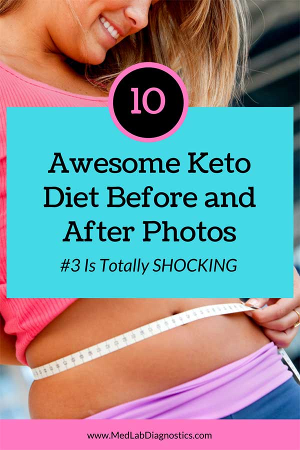 keto diet before and after