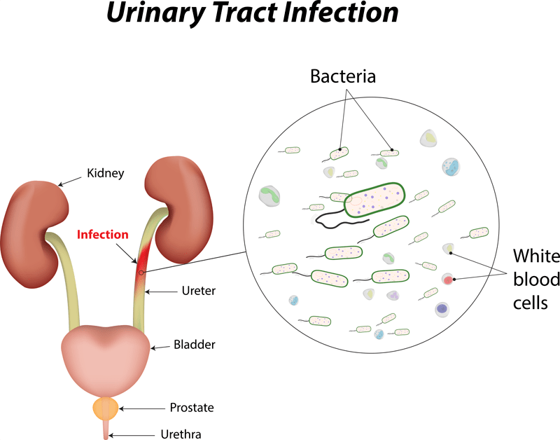 Urinary Tract Diagram